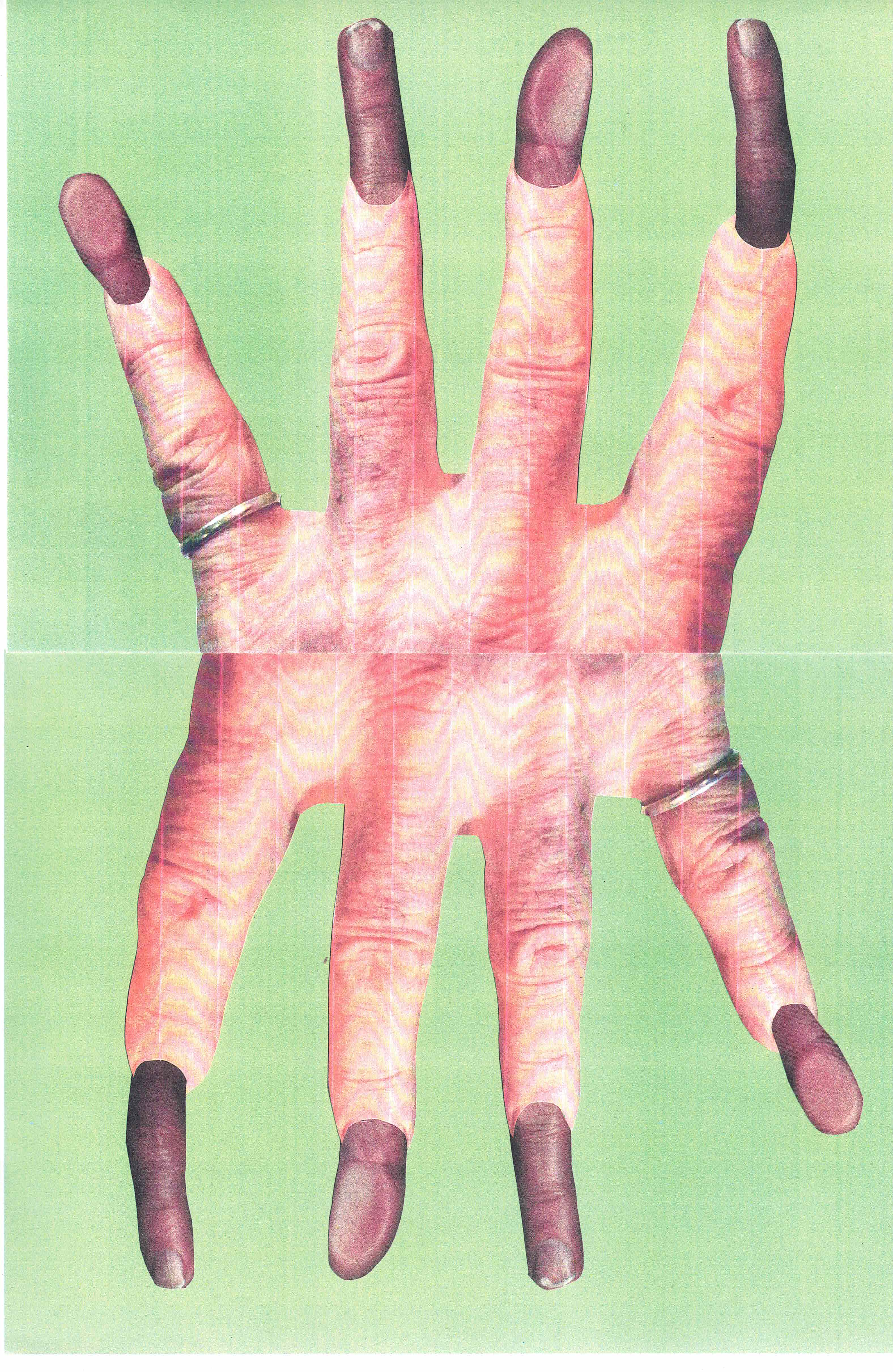 Fingerhand